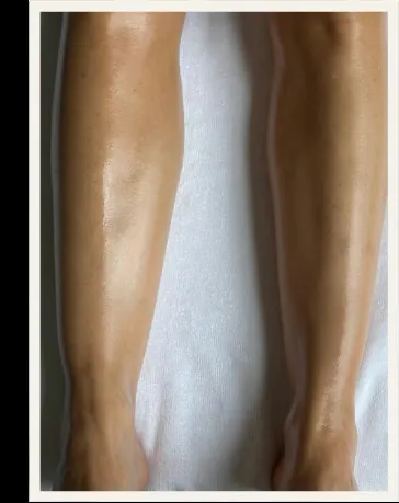 Después — Drenaje