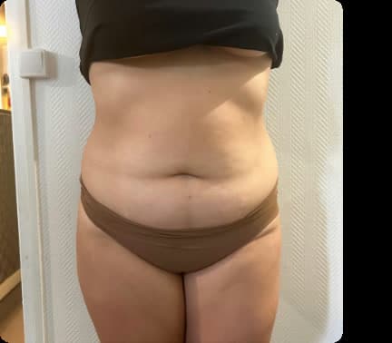 Avant — Maderoterapia