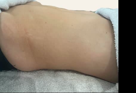 Avant — Maderoterapia